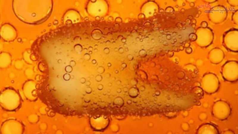 dental cavity with acid